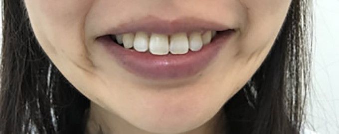 After