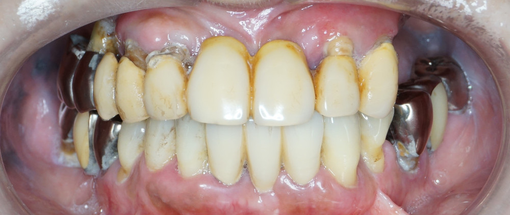 Before