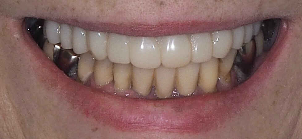 After